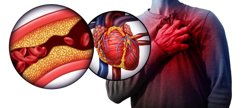 Heart attack
Key Findings from ICMR & AIIMS Research: